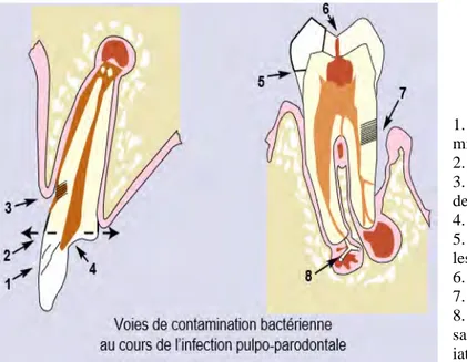 Figure 6: Les différentes voies de pénétration bactérienne à l'origine de l'infection pulpo-parodontale (38)