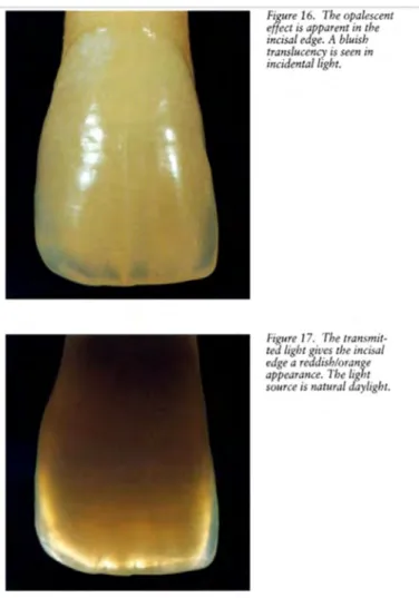 Figure 14: Opalescence du halo incisif  50