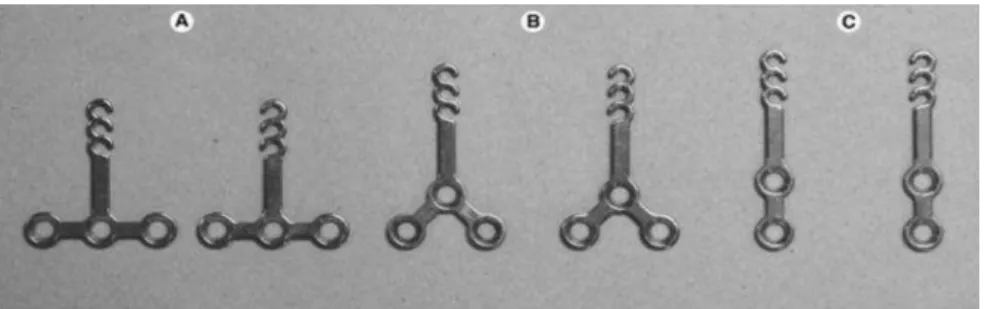 Fig 5 : SAS, plaques d’ancrage en titane ; A : plaque en « T », B : plaque en « Y », C : plaque en « I »  (76) 