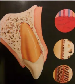 Figure 11 : Luxation latérale (5)
