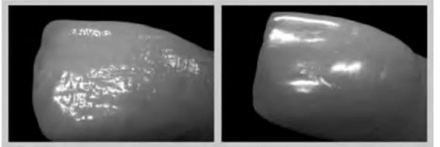 Fig 7. Textures de surface d'une dent jeune (gauche) et d'une dent âgée (droite), d'après Pignoly et al, 2010