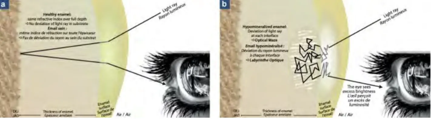 Fig 8. Influence des règles optiques sur la perception de la teinte de la dent, Denis et al, 2013