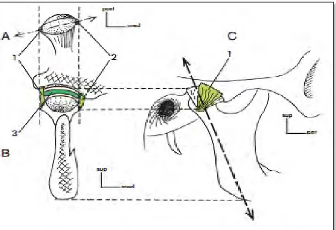 Figure 1 : ligaments collatéraux de l’ATM en vue supérieure (a), coupe faciale (b) et  vue frontale (c)1 ligament latéral, 2 ligament médial, 3 disque articulaire