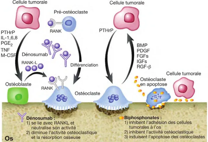 Figure 1 :  Issue de Fornier et Coll.(15)  « Les cellules tumorales sécrètent un certain nombre de  cytokines et facteurs, dont le peptide lié à l’hormone parathyroïdienne (PTHrP) et d’autres, qui  stimulent la  production du RANK L (receptor activator of 