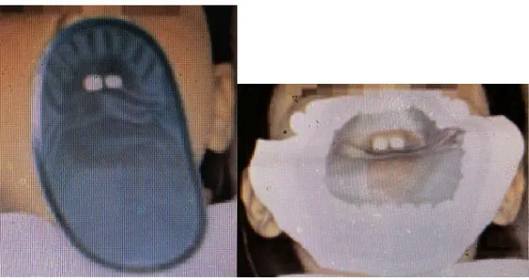 Figure	  20.	  (71)	  :	  Quickdam	  à	  gauche	  et	  Drydam	  à	  droite	   	  