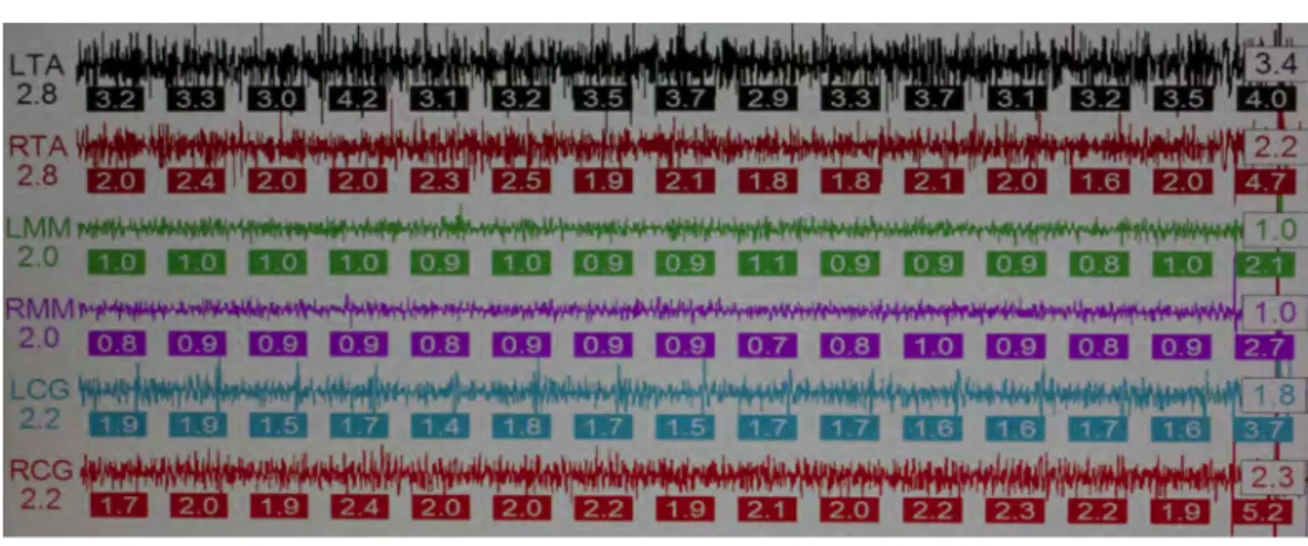 Figure 18: Scan 9 à 50 minutes 