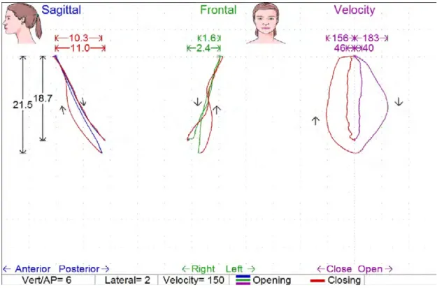 Figure 23: Scan 2 