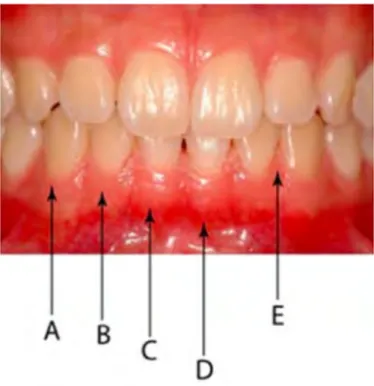 Figure	  4	  :	  Structures	  du	  parodonte	  superficiel	  
