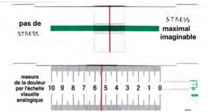 Figure 6 : Recto-verso de la réglette proposée à l’enfant pour évaluer son stress 