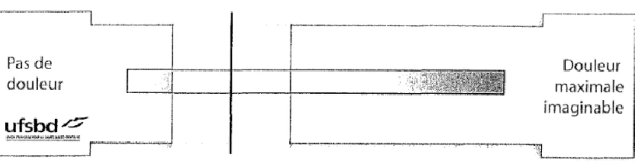 Figure 5: Face d’une Echelle Visuelle Analogique présentée au patient. (16) 