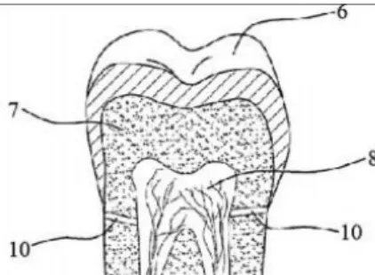 Figure 8 : Localisation des micro-tunnels après percée laser (106) 