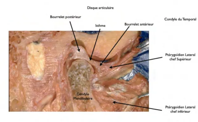 Figure 4 : Coupe anatomique d'une articulation temporo-mandibulaire (4) 