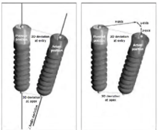 Figure 11: image illustrant les différents paramètres de comparaison de placement implantaire  (25)