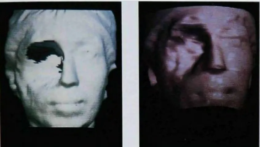 Figure 21 : image 3D du visage obtenue par scanner surfacique. A gauche, avant traitement  informatique
