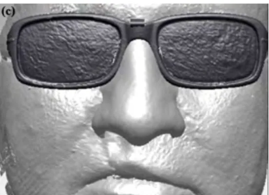Figure 30 : modèle virtuel d’une épithèse nasale retenue par une monture de lunette. (Ciocca  2010)