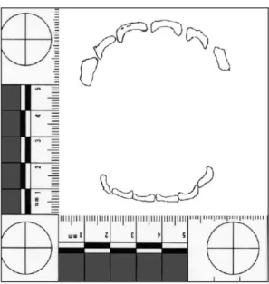 Figure 16 : Résultat obtenu après tracé sur film transparent (44)