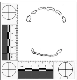 Figure 19 : Résultat obtenu après impression du tracé sur film transparent (44)