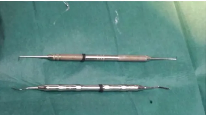 Figure 11: Spatule à bouche et fouloir utilisés pour une obturation au Super  EBA (photo prise au cabinet du praticien avec lequel nous avons collaboré) 