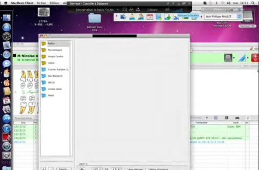 Figure 15: Capture d’écran de l’accès au dossier patient via le logiciel Macdent avec la  fenêtre radiographie ouverte