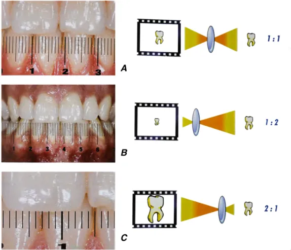 Fig. 9 : Schématisation du rapport 1 :1 et image obtenue : à chaque millimètre de   l’image correspond 1 mm d’objet réel (Fig