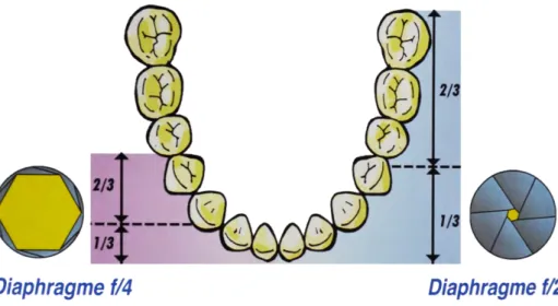 Fig. 10 : Schéma représentant les différentes profondeurs de   champ en fonction du degré d’ouverture du diaphragme