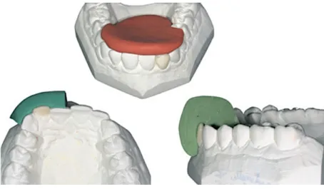 Figure 5 : Photographies des guides de coupe dans les trois sens de l'espace (32) 