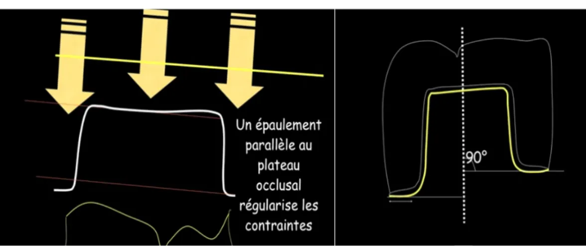 Figure 22 : Schéma illustrant le parallélisme des limites et des surfaces occlusales au plan  d’application des forces masticatoires (39) 