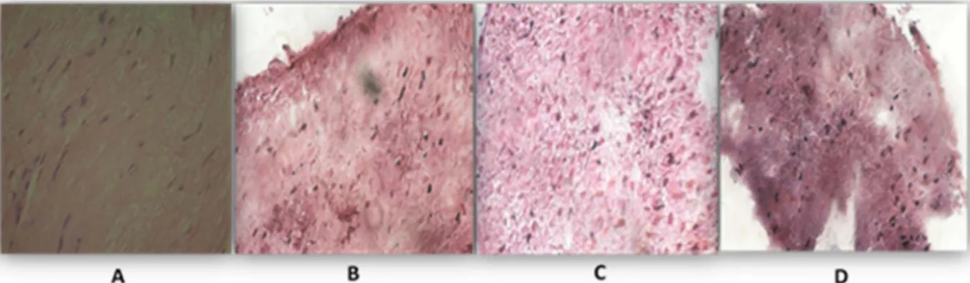 Fig. 1. Cross section through frog sciatic nerve (Hematoxylin-Eosin X 640). A: Sham control, B: ligation for two hours on myelin sheaths and, C: ligation for 24 h h on myelin sheaths, D: following 72 h.