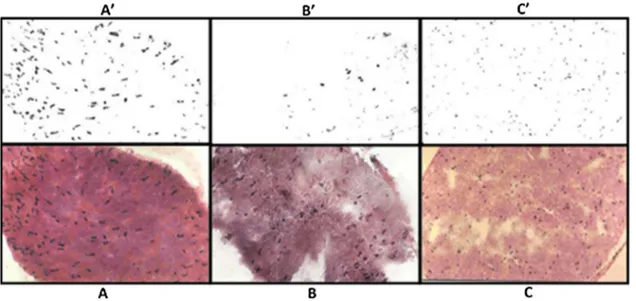 Fig. 4. Quantitative analysis of Schwann cells following ligation or ligation associated with injection of iron sulphate