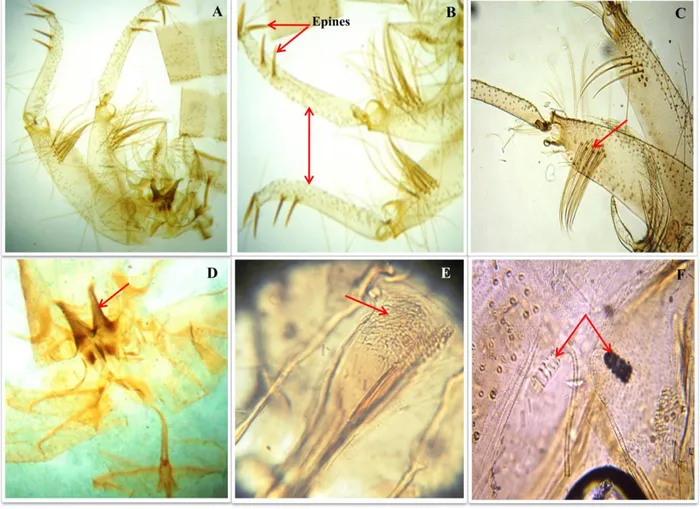 Figure  11:  Critères  d’identifications  morphologiques  de    Phlebotomus  papatasi:       A