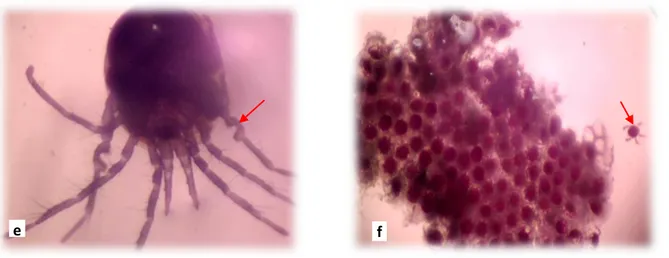 Figure 22: Piona alpicola femelle; a: vue dorsale, b: vue ventrale) (G. X 150), 