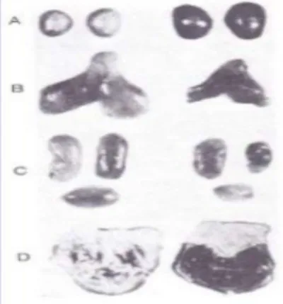 Figure 1.Triade typique de la phase de réaction du syndrome général d’adaptation de Selye.