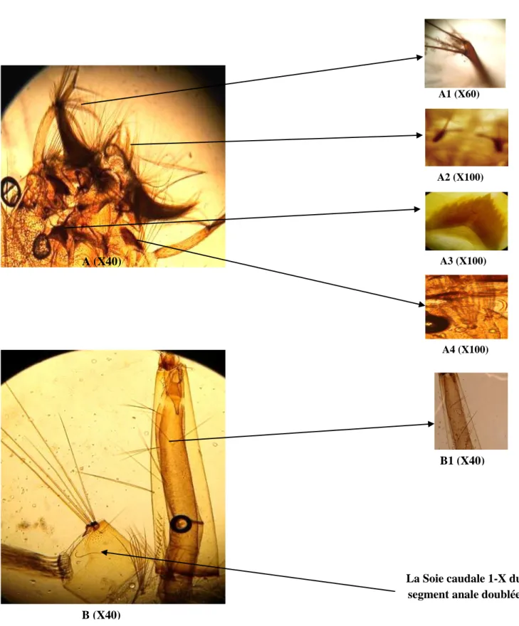 Figure 13: Larve de Culex torrentum. A : tête. A1: antenne. A2: l’épine  préclypéale. A3:  mentum