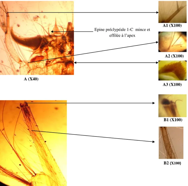 Figure 16. Larve de Culex deserticola. A: tête. A1: antenne.  A2: soie 5-C et 6-C. A3 :  mentum