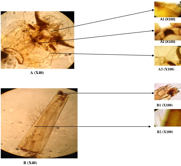 Figure 17: Larve de Culex modestus. A: tête A1: l’épine préclypéale. A2: mentum. A3: soie  5-C