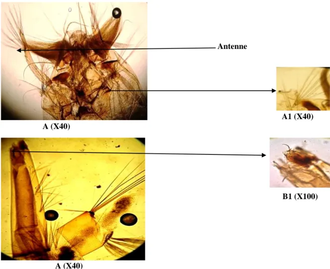 Figure 18: Critères morphologiques d’identification de Culex pusillus. A: tête de la larve