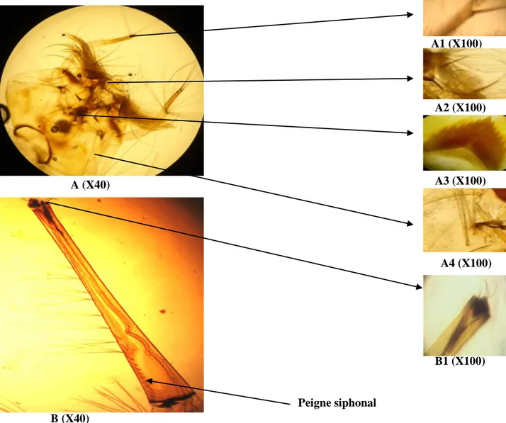 Figure 20: Culex hortensis (larve). A: la tête. A1: les soies : 3-A et 4-A. A2: l’épine   éclypeale