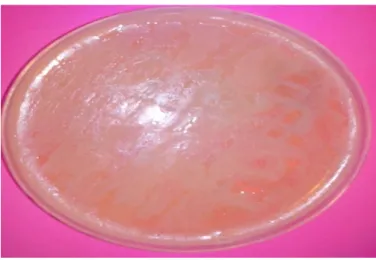 Figure 13. Croissance du consortium sur la surface de la gélose nutritive (GN) après  24 h 