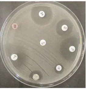 Tableau XIV.  Valeurs  des  diamètres  des  zones  d’inhibition  des  entérobactéries  à  lactose  positif traité par l’huile d’olive