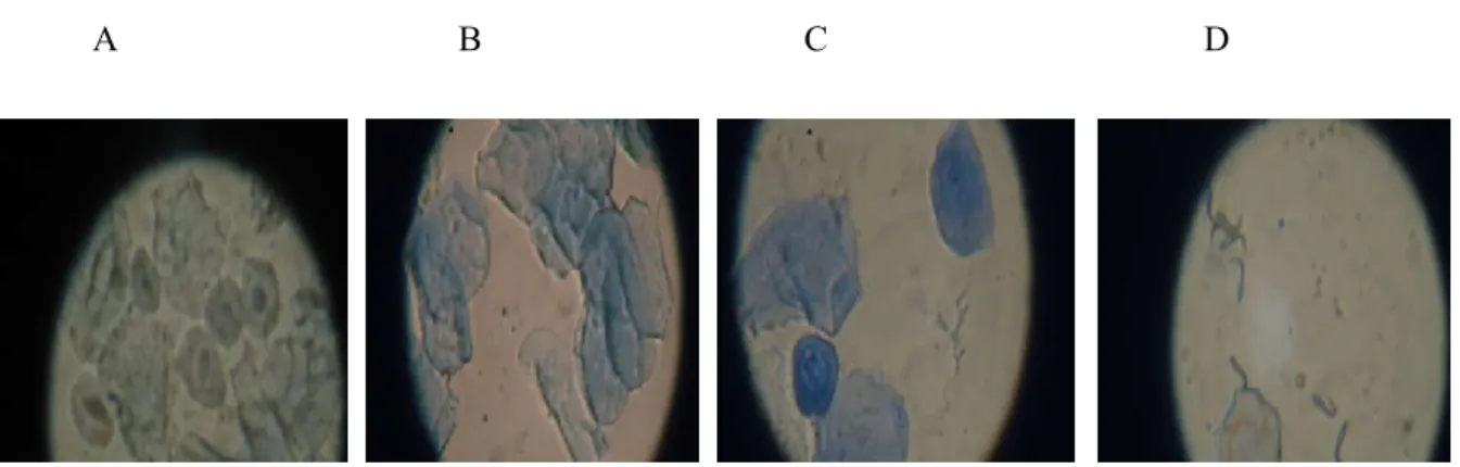 Figure 2 : Observation microscopique des stades œstraux de la rate  Wistar Albinos.A : Proestrus cellule  épithéliales nucléées et cellules épithéliales cornifiées ; B : Œstrus, présence de cellules épithéliales; C : 