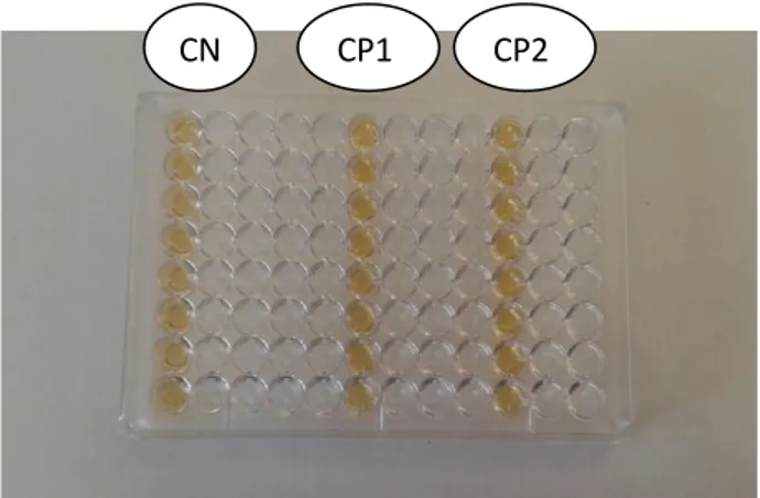 Figure 06 :     Inoculation de la microplaque. Contrôle Négatif (CN) (sans AHLs) Contrôle Positif 1 (CP1) (avec C6-HSL)  Contrôle Positif 2 (CP2) (avec C8-HSL) 100 μL culture E.faecalis en bouillon M17 à 1 % glucose + 100 μL de bouillon M17 à 1 % glucose stérile 100 μL culture E.faecalis en bouillon M17 à 1 % glucose + 99 μL bouillon M17 à 1 % glucose stérile + 1 μL C6-HSL  100 μL culture E.faecalis en bouillon M17 à 1 % glucose + 99 μL bouillon M17 à 1 % glucose stérile + 1 μL C8-HSL CN CP1 CP2 