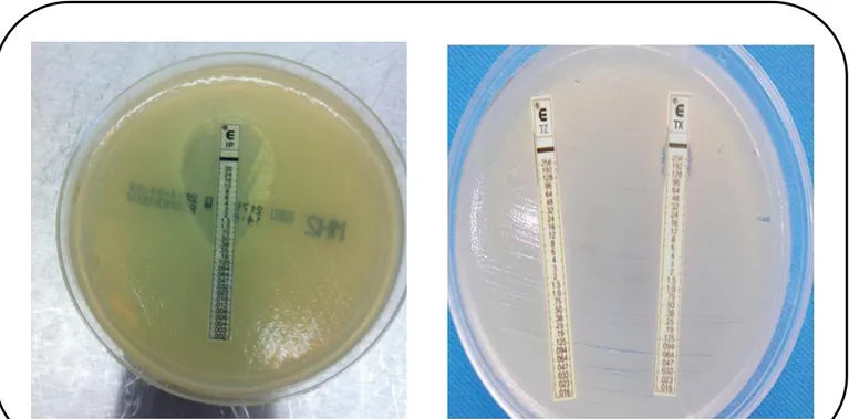 Figure 07 : Exemple de résultat de la détermination des CMIs  des bêta-lactamines par E-test