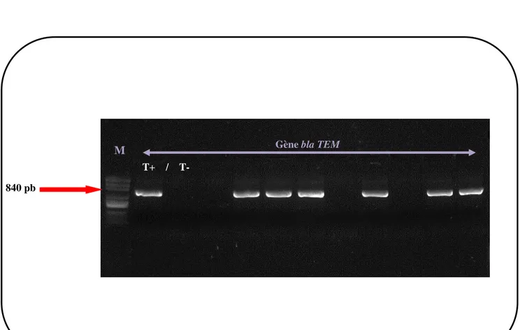 Figure 14 : Gel  d’agarose après électrophorèse des produits de PCR du gène bla TEM des 