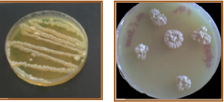 Figure 9: Mise en évidence de l’activité xylanolytique de la Cpt29 sur milieu Nammori  solide par  le test au rouge Congo