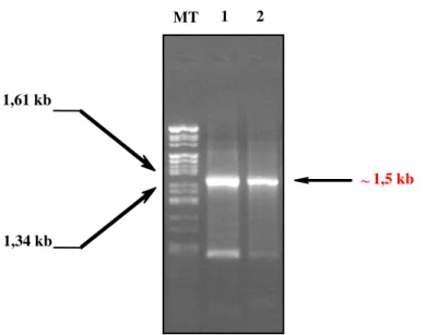 Figure 17 :  Analyse du produit PCR (taille attendue) de l’amplification du gène codant pour 