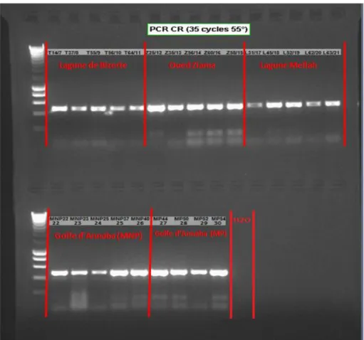 Figure 25. Visualisation après coloration au BET et électrophorèse sur gel d’agarose à 2 %,  des produits PCR pour la région de contrôle (Mq: marqueur de taille, pb: paires de bases)