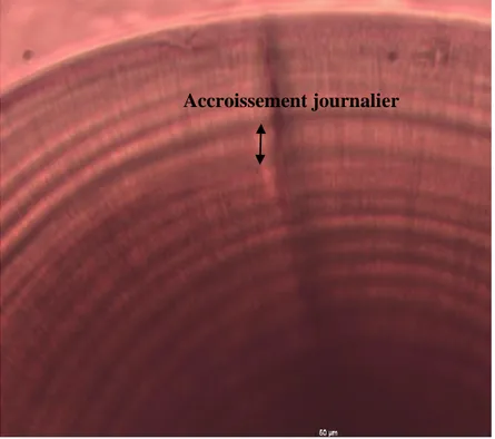 Figure  13.  Partie  périphérique  d’une  sagitta  de  plie  observée  au  microscope  optique 