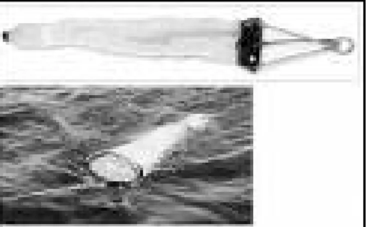 Figure 4 : Filet WP2.  Filet  cylindro-conique de 30 cm de diamètre, une ouverture de 0,15m² et 170  µm de   vide de maille