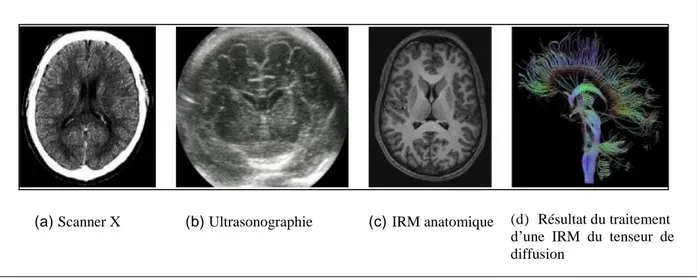 Figure 1.3 : Différentes modalités d’imagerie appliquées au cerveau [ROC06]. 