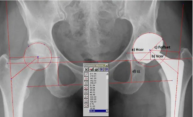 Figure  6:  Radiographic  measurement  a)  Horizontal  center  of  rotation  (H COR )  b)  Vertical  center  of 